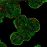 Immunocytochemistry/Immunofluorescence: IL-4R alpha Antibody [NBP3-21332] -