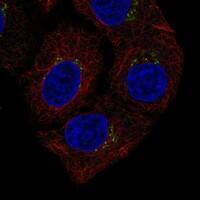 Immunocytochemistry/Immunofluorescence: Cathepsin L Antibody [NBP3-21333] -