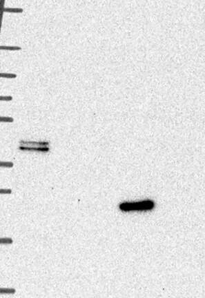 Western Blot: Cathepsin L Antibody [NBP3-21333] -