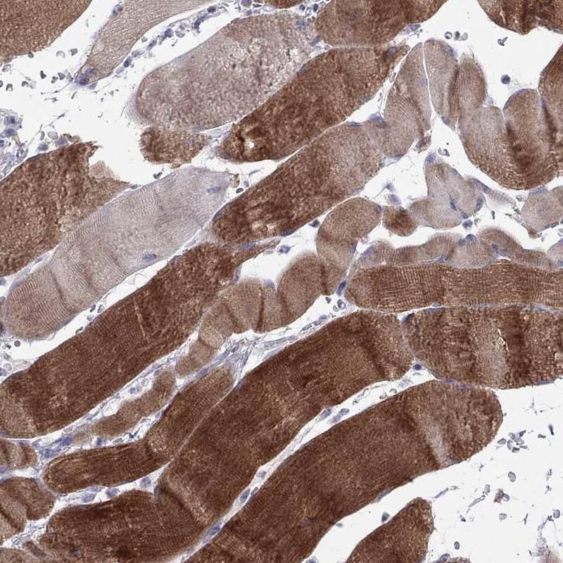 Immunohistochemistry-Paraffin: PPP1R3A Antibody [NBP3-21334] -