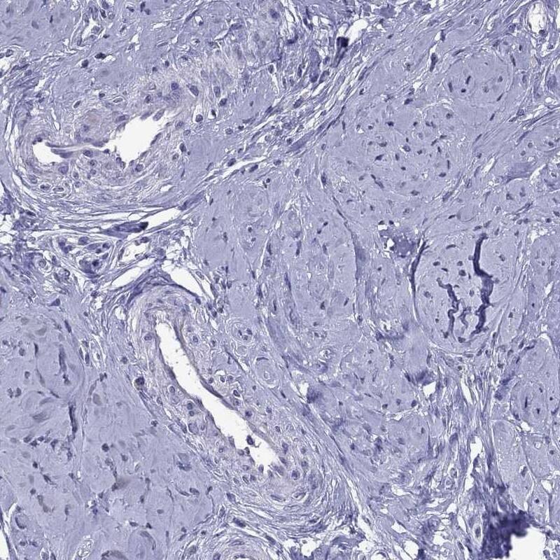 Immunohistochemistry-Paraffin: PPP1R3A Antibody [NBP3-21334] -