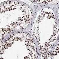 Immunohistochemistry-Paraffin: RPRD1B Antibody [NBP3-21336] -