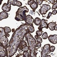 Immunohistochemistry-Paraffin: u-Plasminogen Activator/Urokinase Antibody [NBP3-21338] -