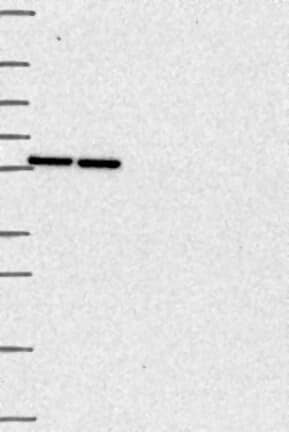 Western Blot: Thymopoietin/LAP2 Antibody [NBP3-21339] -