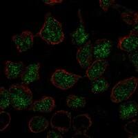 Immunocytochemistry/Immunofluorescence: LMO2 Antibody [NBP3-21341] -