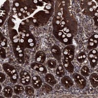 Immunohistochemistry-Paraffin: HDAC4+5+9 Antibody [NBP3-21347] -