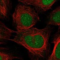 Immunocytochemistry/Immunofluorescence: Neurogenin-1 Antibody [NBP3-21354] -