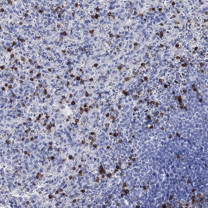 Immunohistochemistry-Paraffin: TDAG8/GPR65 Antibody [NBP3-21356] -