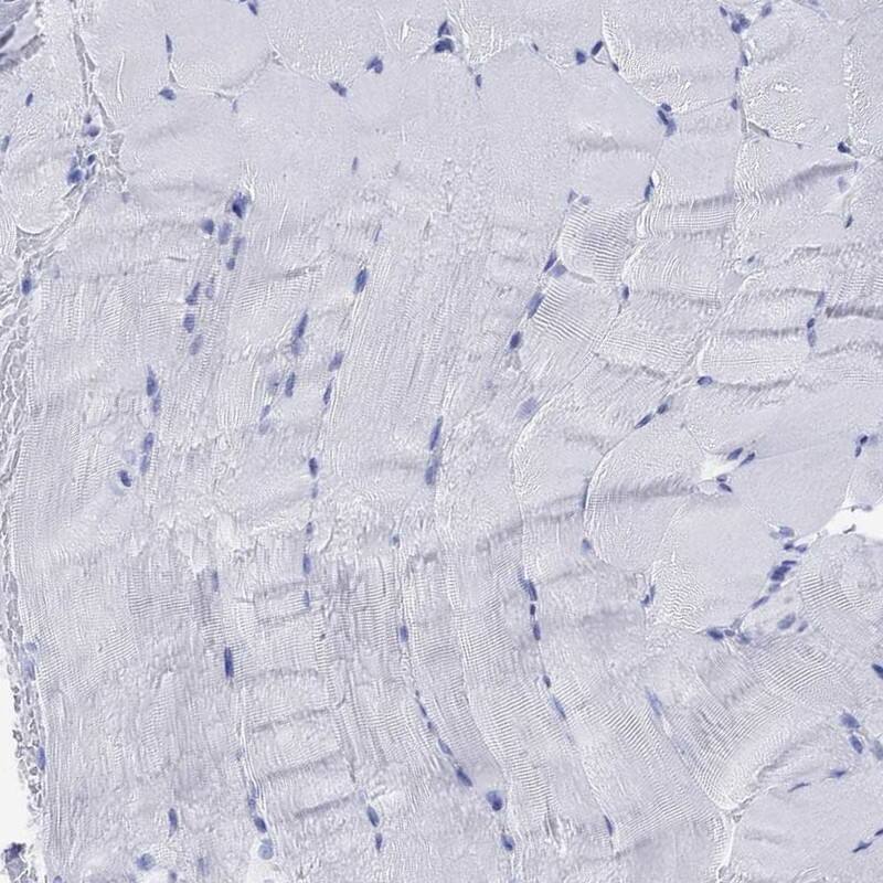 Immunohistochemistry-Paraffin: TDAG8/GPR65 Antibody [NBP3-21356] -
