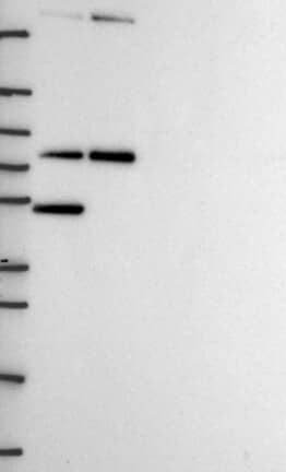 Western Blot: MTA2 Antibody [NBP3-21357] -