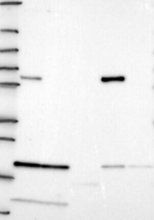 Western Blot: ALDH4A1 Antibody [NBP3-21358] -