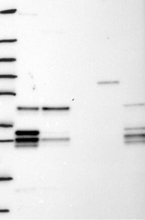 Western Blot: PCBP2 Antibody [NBP3-21359] -