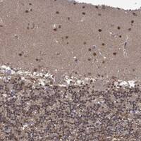 Immunohistochemistry-Paraffin: PCBP2 Antibody [NBP3-21359] -