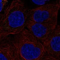 Immunocytochemistry/Immunofluorescence: IL-27R alpha/WSX-1/TCCR Antibody [NBP3-21361] -