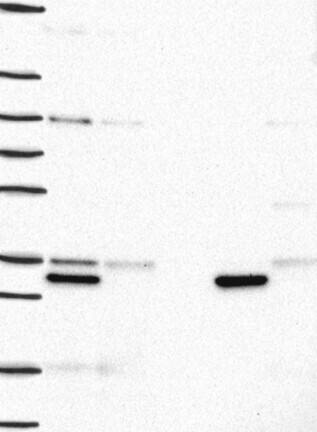 Western Blot: Histamine N-Methyltransferase/HNMT Antibody [NBP3-21364] -