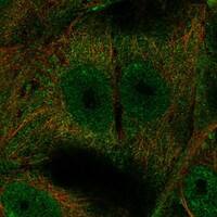 Immunocytochemistry/Immunofluorescence: OSCAR Antibody [NBP3-21366] -