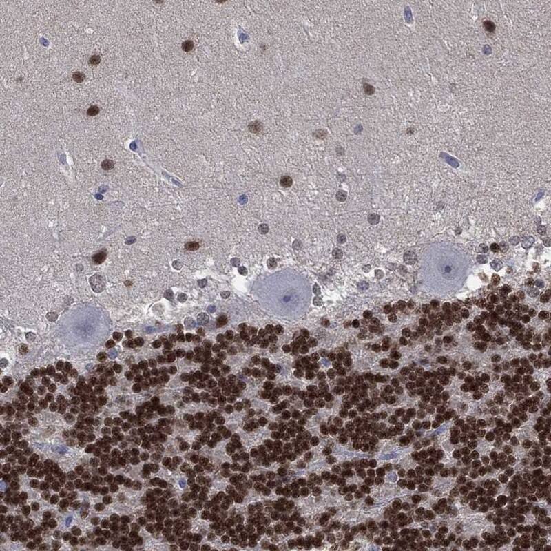 Immunohistochemistry-Paraffin: ZNF238 Antibody [NBP3-21367] -