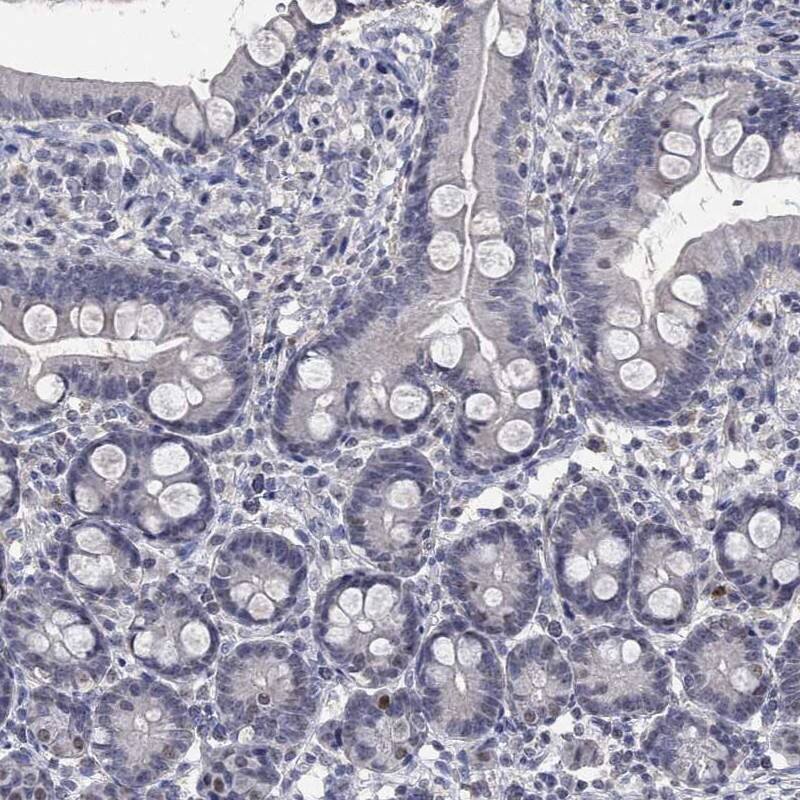 Immunohistochemistry-Paraffin: ZNF238 Antibody [NBP3-21367] -