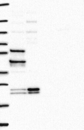 Western Blot: ZNF238 Antibody [NBP3-21367] -
