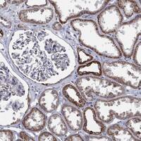 Immunohistochemistry-Paraffin: PSMG4 Antibody [NBP3-21369] -