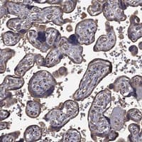 Immunohistochemistry-Paraffin: VEGFR3/Flt-4 Antibody [NBP3-21370] -