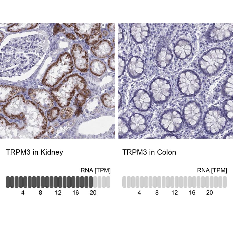 Immunohistochemistry-Paraffin: TRPM3 Antibody [NBP3-21371] -