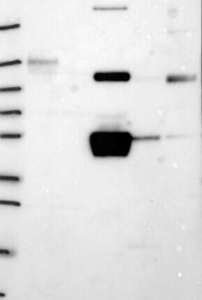 Western Blot: Fibrinogen gamma chain Antibody [NBP3-21374] -
