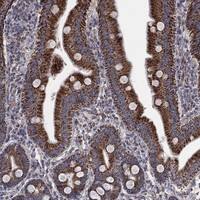 Immunohistochemistry-Paraffin: PEDFR/PNPLA2/ATGL Antibody [NBP3-21380] -