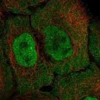 Immunocytochemistry/Immunofluorescence: ADK Antibody [NBP3-21383] -