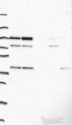 Western Blot: ADK Antibody [NBP3-21383] -