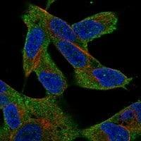 Immunocytochemistry/Immunofluorescence: TAK1 Antibody [NBP3-21385] -