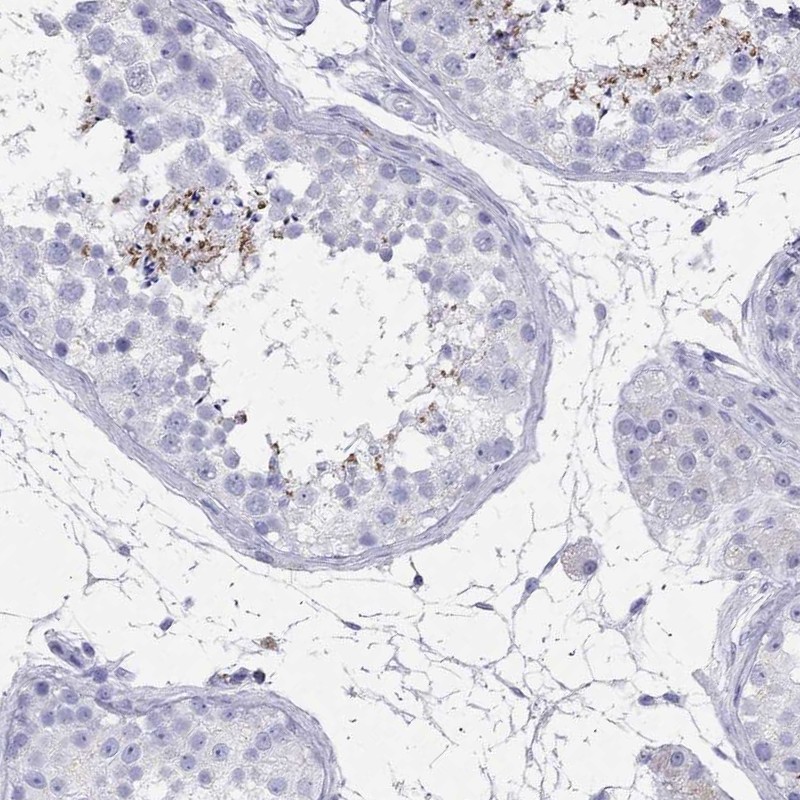 Immunohistochemistry-Paraffin: ARMC12 Antibody [NBP3-21386] -