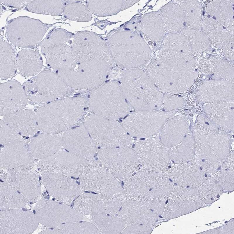 Immunohistochemistry-Paraffin: ARMC12 Antibody [NBP3-21386] -