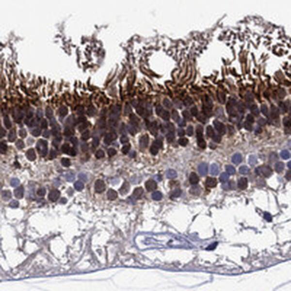 Immunohistochemistry-Paraffin: Musashi-1 Antibody [NBP3-21389] -