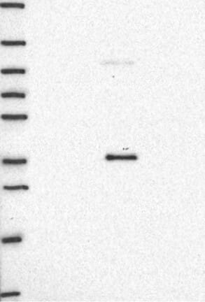 Western Blot: alpha 1-Microglobulin Antibody [NBP3-21390] -