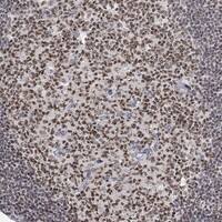 Immunohistochemistry-Paraffin: KLF12 Antibody [NBP3-21391] -