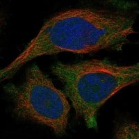 Immunocytochemistry/Immunofluorescence: TULP2 Antibody [NBP3-21392] -