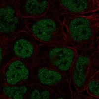 Immunocytochemistry/Immunofluorescence: TBX3 Antibody [NBP3-21394] -