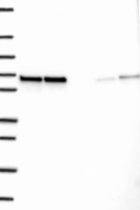 Western Blot: CCDC47 Antibody [NBP3-21397] -