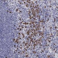 Immunohistochemistry-Paraffin: IGSF8/CD316 Antibody [NBP3-21398] -