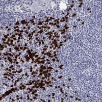 Immunohistochemistry-Paraffin: IRF5 Antibody [NBP3-21400] -