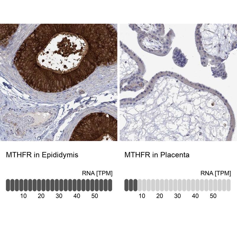 Immunohistochemistry-Paraffin: MTHFR Antibody [NBP3-21401] -