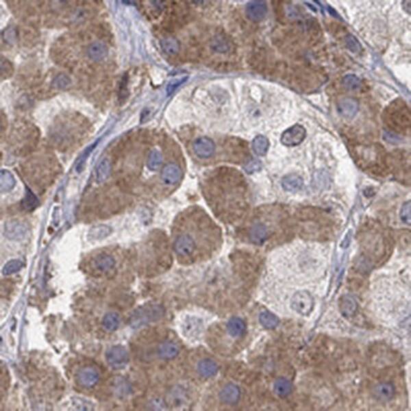 Immunohistochemistry-Paraffin: MTHFR Antibody [NBP3-21401] -