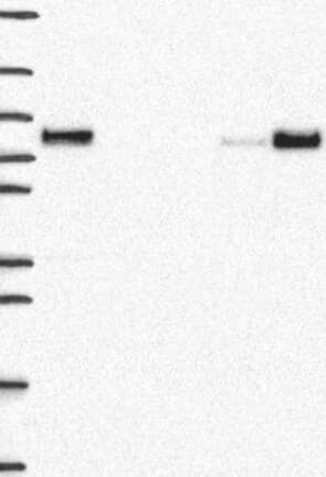 Western Blot: MTHFR Antibody [NBP3-21401] -