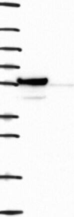 Western Blot: Nuf2 Antibody [NBP3-21404] -