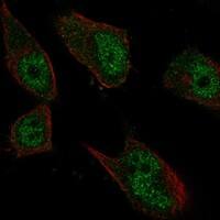 Immunocytochemistry/Immunofluorescence: Nuf2 Antibody [NBP3-21404] -