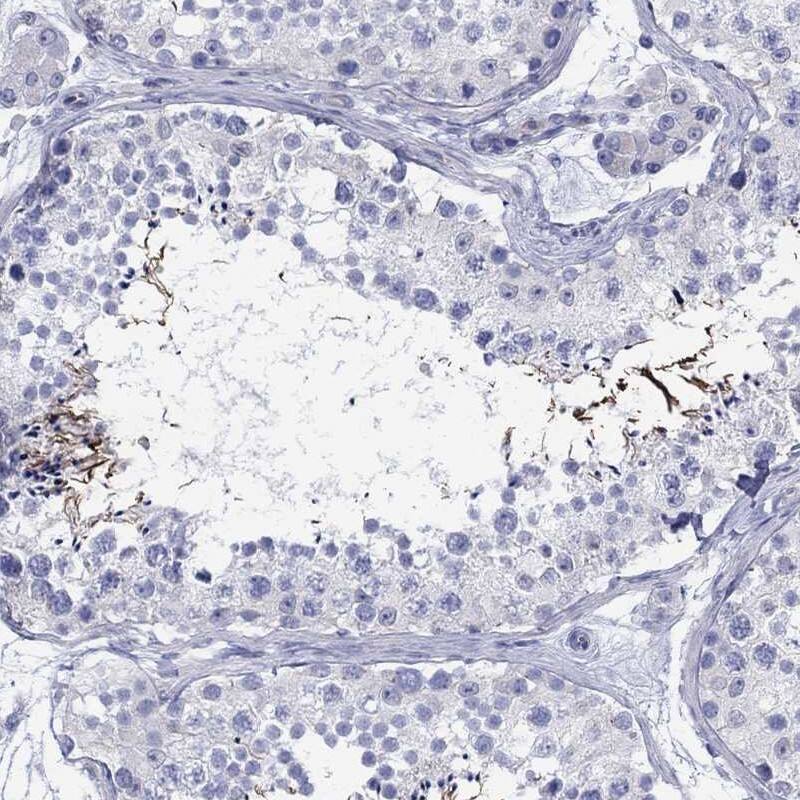 Immunohistochemistry-Paraffin: SH2D7 Antibody [NBP3-21405] -