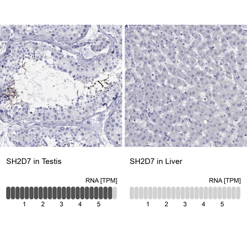 Immunohistochemistry-Paraffin: SH2D7 Antibody [NBP3-21405] -