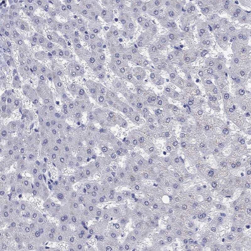 Immunohistochemistry-Paraffin: SH2D7 Antibody [NBP3-21405] -