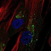 Immunocytochemistry/Immunofluorescence: Chitinase 3-like 1 Antibody [NBP3-21409] -